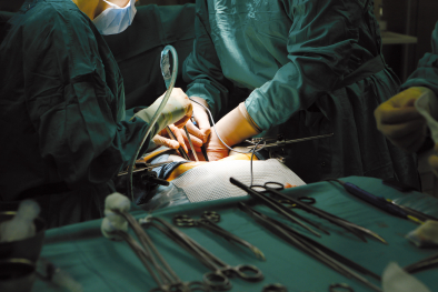 Operation